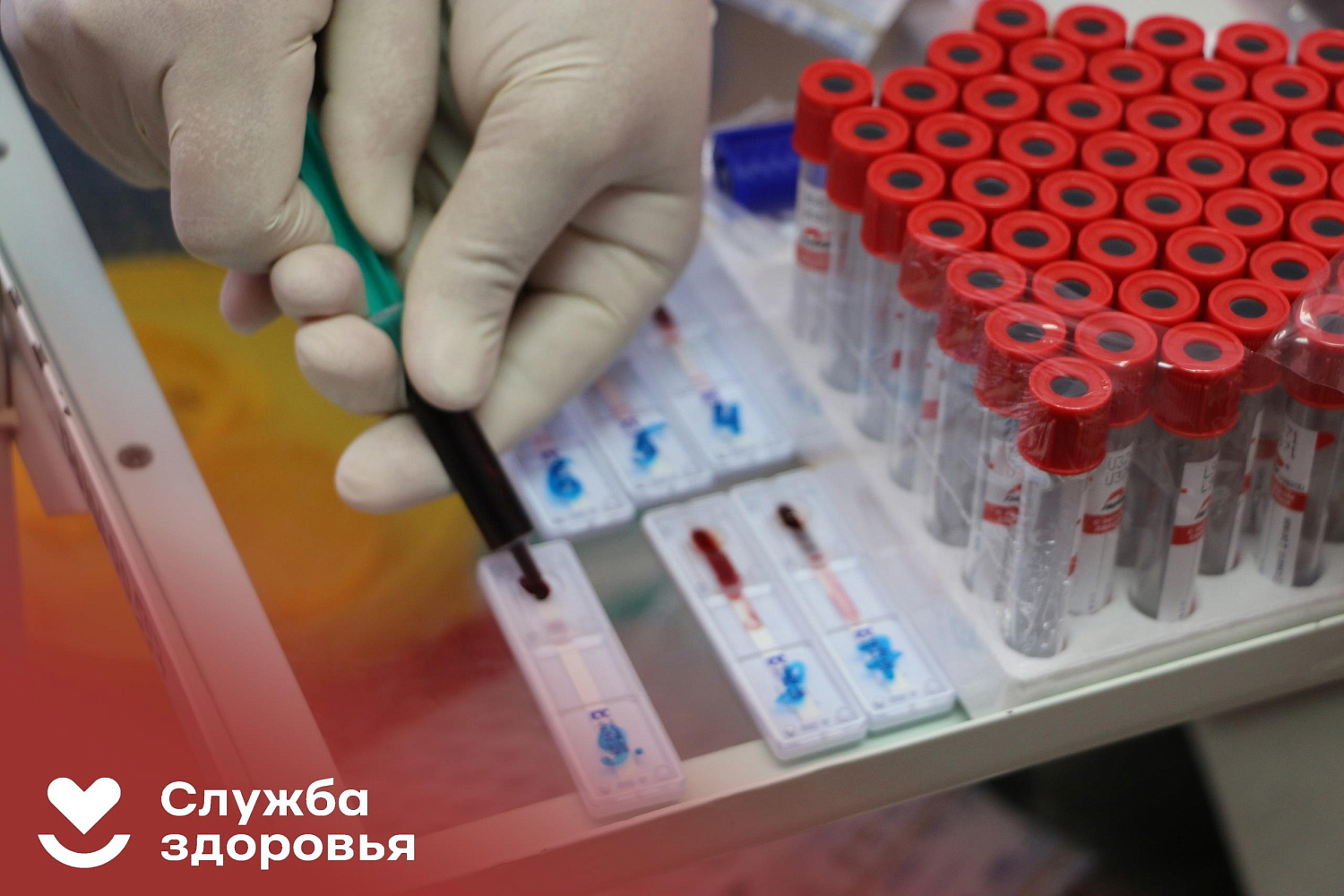 Задайте вопрос о ВИЧ